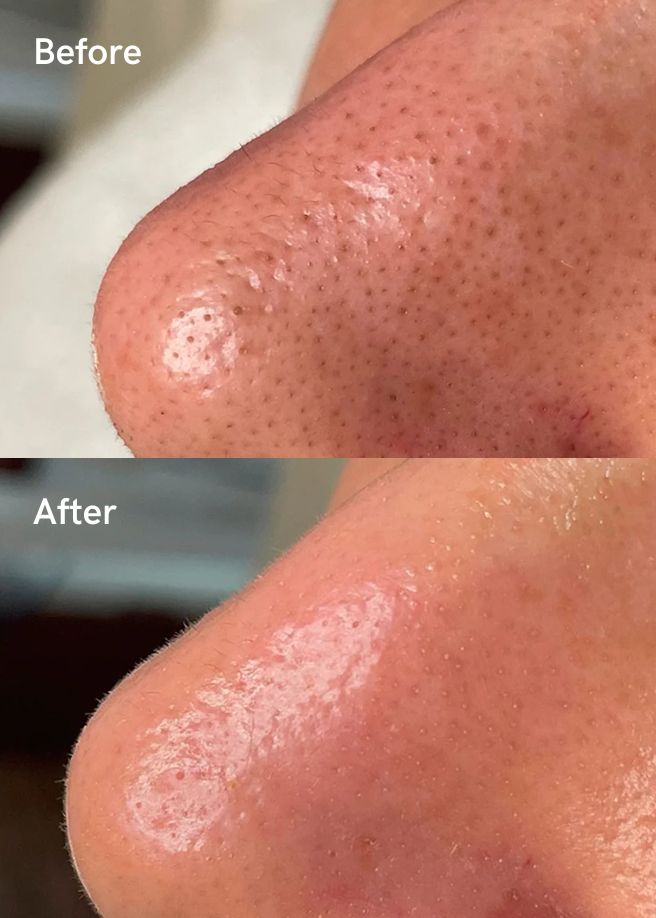 Medical-Grade Facials results