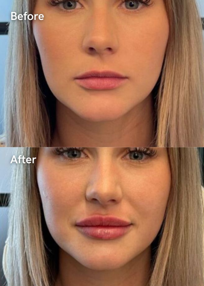 Autumn Facial Plan results