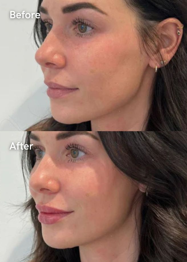Autumn Facial Plan results