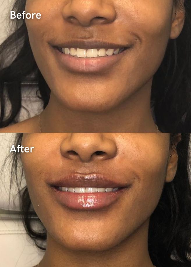 Autumn Facial Plan results